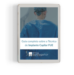 Ebook Guia completo sobre a técnica de implante capilar fue