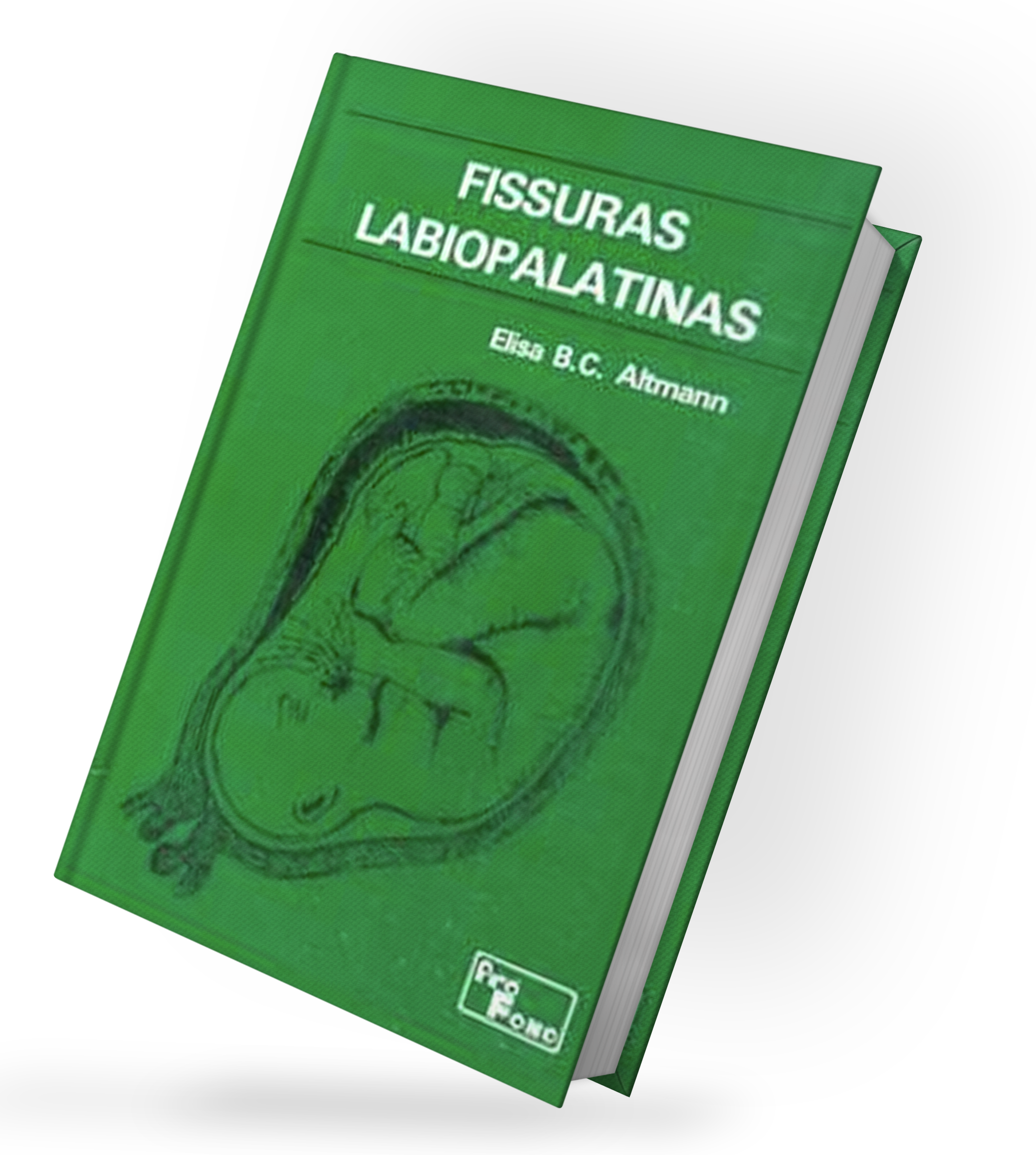 Fissuras Labiopalastinas